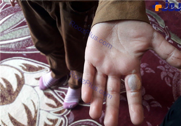ماجرای معلمی که با خط کش داغ بچه ها را تنبیه می کند+عکس