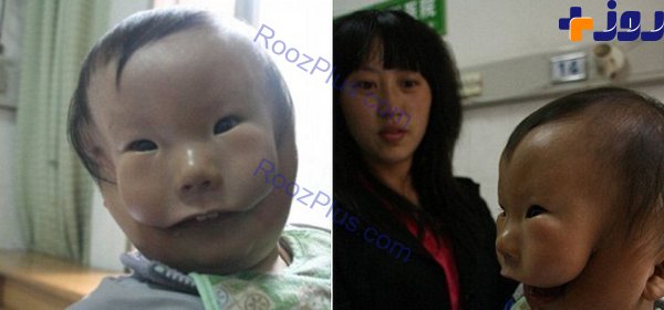 نوزاد چینی با ماسکی روی صورتش به دنیا آمد+عکس +18