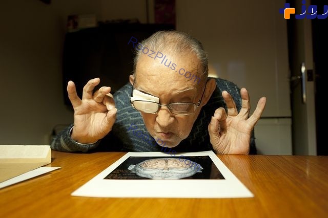 عکس روز نشنال جئوگرافیک | نگاه با دقت یک مرد به اسکن مغز انسان
