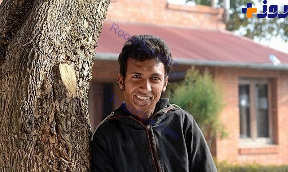 تصاویری از سوختگی وحشتناک پسر نپالی