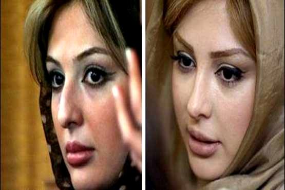 تفاوت چهره برخی از بازیگران زن ایرانی ، قبل و بعد از عمل زیبایی! + تصاویر