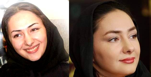 تفاوت چهره برخی از بازیگران زن ایرانی ، قبل و بعد از عمل زیبایی! + تصاویر