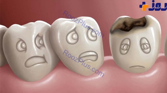 آیا کرم دندان وجود دارد؟