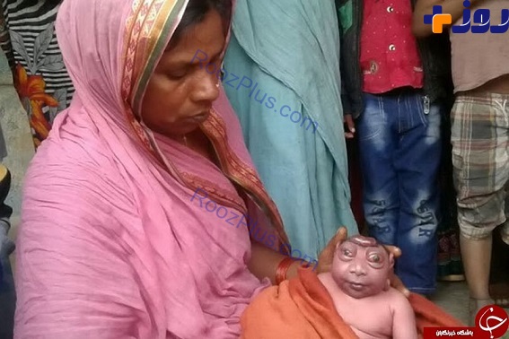تولد نوزادی عجیب الخلقه در هندوستان! +تصاویر