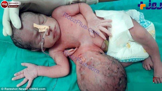 تصاویری دلخراش از بدنیا آمدن یک نوزاد عجیب! 18+