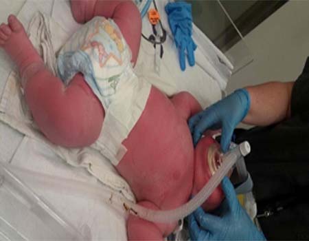 تولد نوزادی با هفت کیلوگرم وزن +عکس
