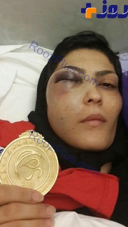 الهه منصوریان ووشوکار در بیمارستان هنگام دریافت مدال +عکس