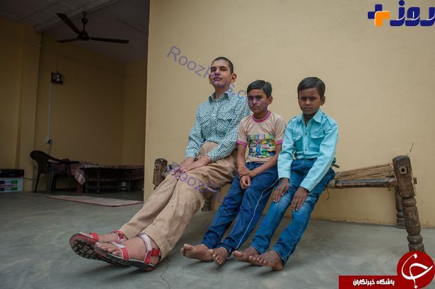 کودک 8 ساله‌ هندی با 2 متر قد! +تصاویر