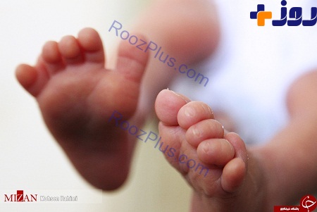 مشکلات پدر کارگر برای درمان نوزاد ۲۴ انگشتی اش + عکس