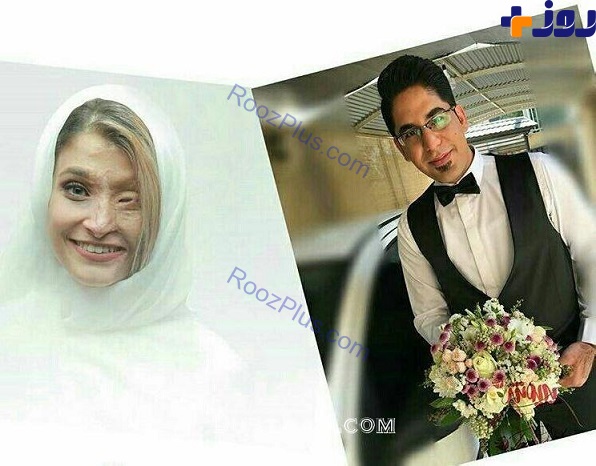 زني كه در اصفهان قرباني اسيدپاشي شده بود ازدواج كرد+عكس