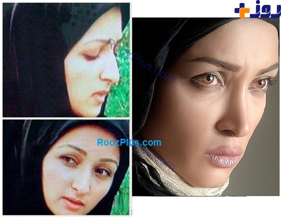 تصویری دیده نشده از بازیگر زن معروف قبل و بعد از عمل زیبایی