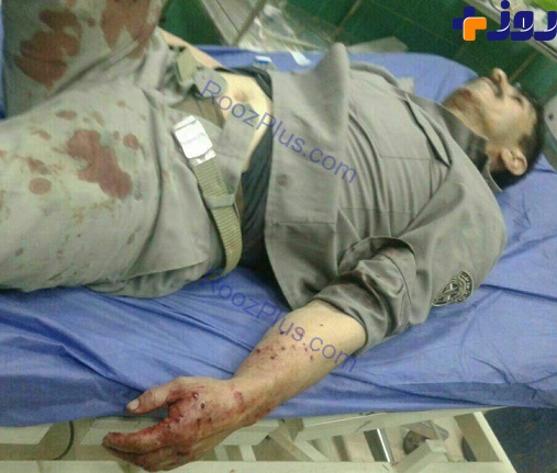 حمله به محیط‌بان در مازندران +عکس