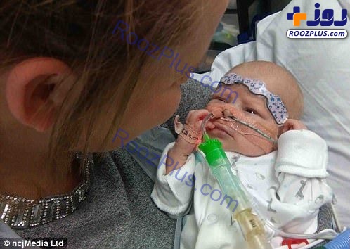 نوزادی که با قلب نصفه به دنیا آمد+تصاویر