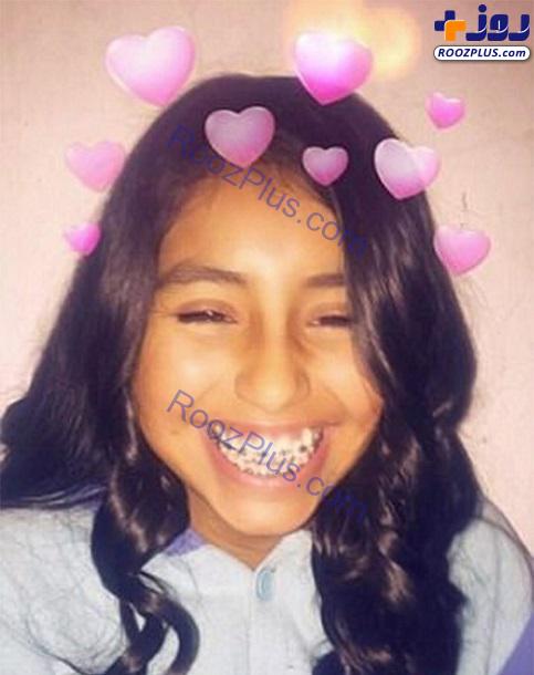 خودکشی عجیب دختر نوجوان بخاطر ارتودنسی! +عکس