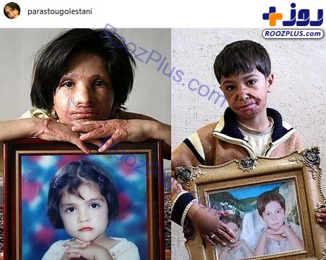 دردآورترین چالش؛ عذاب 10 ساله بچه‌های شین آباد +عکس