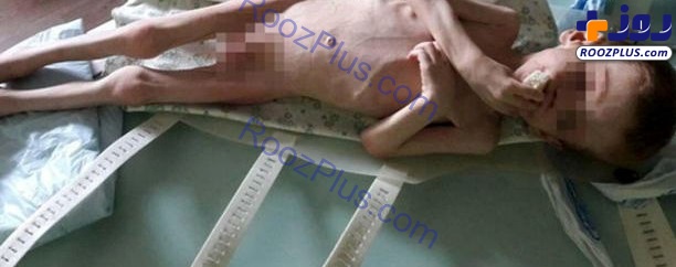 عکس/ شکنجه پسر چهار ساله توسط پدرش