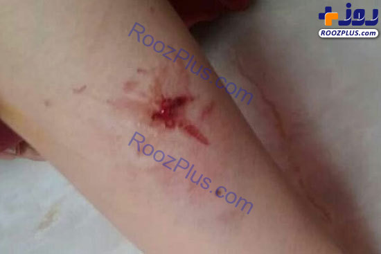 حمله سگ‌های ولگرد به یک زن در لواسان+عکس