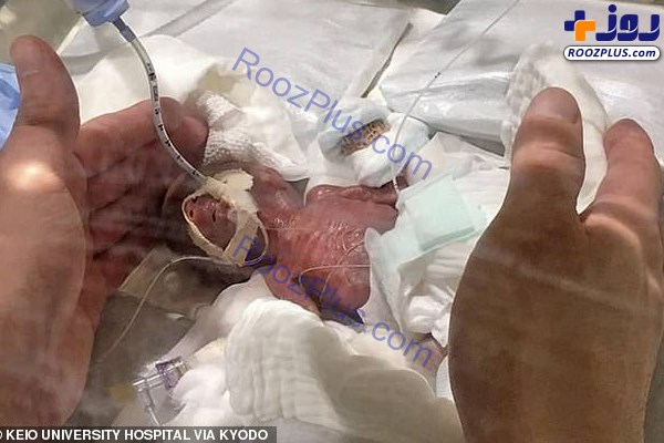 کوچک‌ترین نوزاد پسر دنیا زنده ماند! +تصاویر