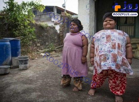 چاق ترین خواهران دنیا با گرسنگی های ترسناک!+عکس