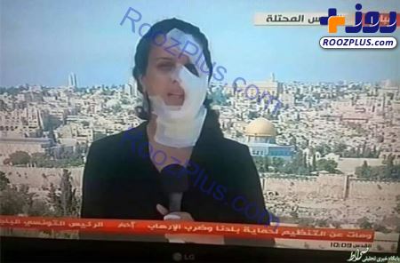 چهره عجیب خبرنگار زن در پخش زنده اخبار +عکس