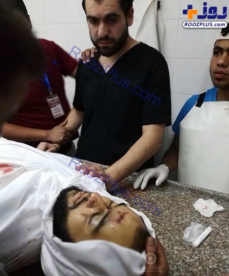 عکس/ صحنه‌ای دردناک که پزشک فلسطینی را در بهت فرو برد