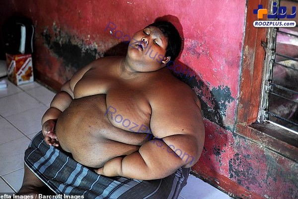 چاق‌ترین کودک جهان پس از لاغری+عکس