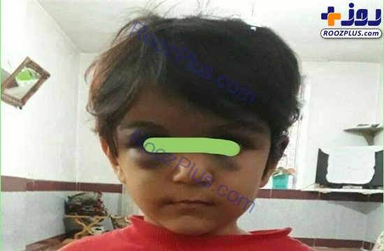 حکم جلب نامادری کودک آزار صادر شد +عکس