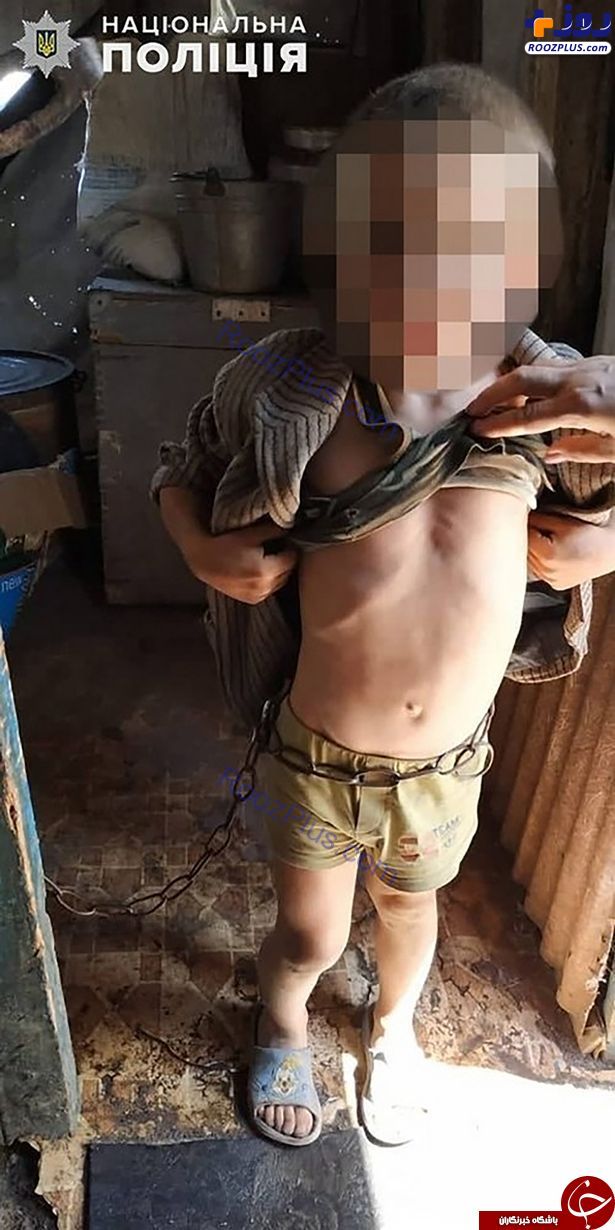 شکنجه عجیب پسر 6 ساله توسط پدر سنگدل/تصاویر