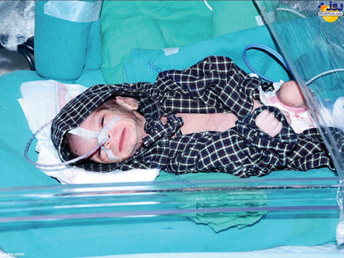 نجات نوزاد دختر زنده به‌گور شده!+عکس