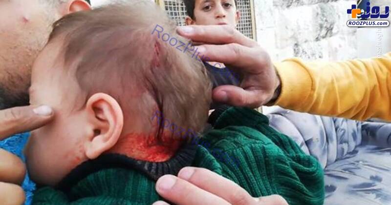 عکس/زخمی شدن نوزاد فلسطینی توسط صهیونیست‌ها