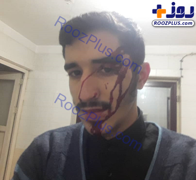 ماجرای ضرب و شتم طلبه بسیجی در تهران +عکس