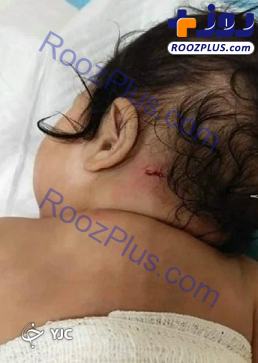 زخمی شدن نوزاد ۵ ماهه در پی حمله میمون+عکس