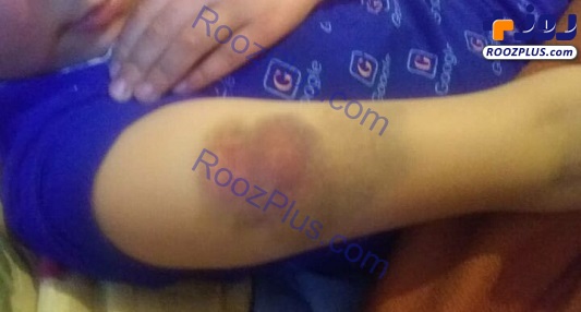 عکسی تلخ از تنبیه بدنی دانش آموز قزوینی توسط معلم!