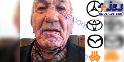 لوگوی بنز روی چانه یک پیرمرد!+عکس