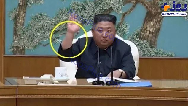 عکس/جای سوزن بر مچ کیم جونگ اون؛ رهبر کره شمالی عمل جراحی انجام داده است؟