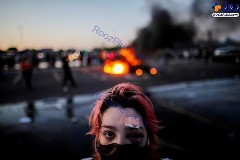 زخمی شدن معترضان با گلوله های پلاستیکی پلیس آمریکا +عکس