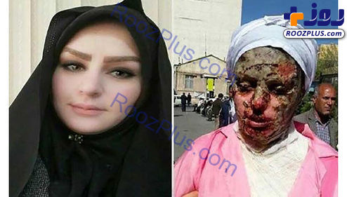 جزئیات مرگ عامل اسیدپاشی به دختر تبریزی در زندان +عکس