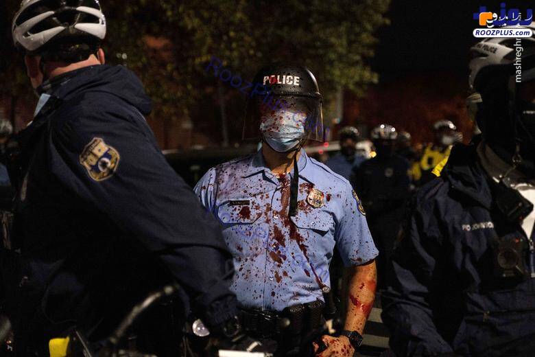 پلیسی درمانده و آغشته به خون پس از درگیری‌های خیابانی در فیلادلفیا +عکس