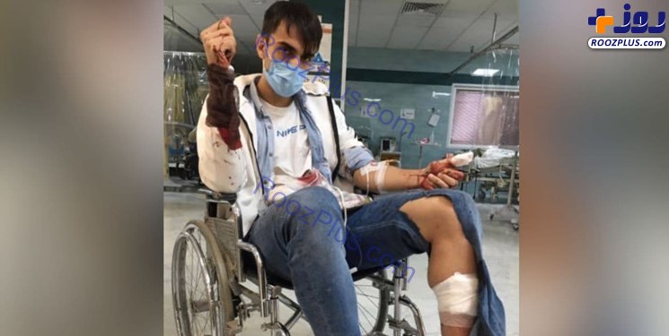 حمله سارقان با چاقو و قمه به فوتبالیست جوان+عکس
