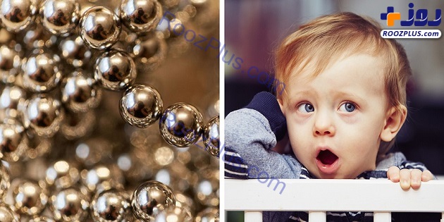 خروج ۲۰۰ توپ مغناطیسی از شکم کودک 2 ساله+ عکس