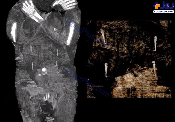 عکس/ اولین مومیایی باردار مصری کشف شد