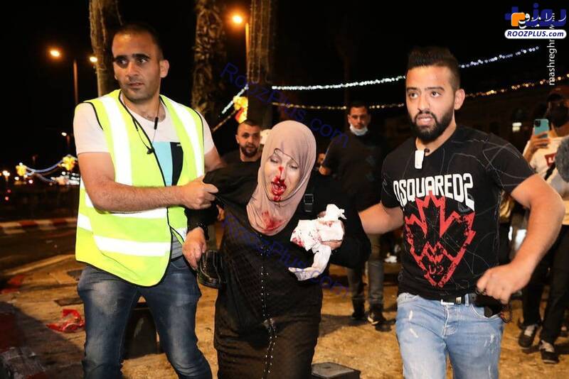 زخمی شدن بانوی فلسطینی به ضرب گلوله اسرائیلی‌ها+عکس