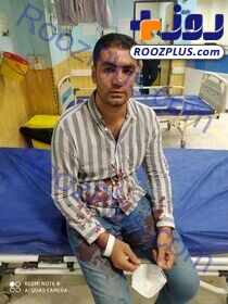 حمله وحشتناک سارقان مسلح به بوکسور ایرانی/ عکس