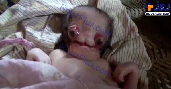 تولد نوزاد عجیب الخلقه با چهره آدم فضایی ها در هند /عکس