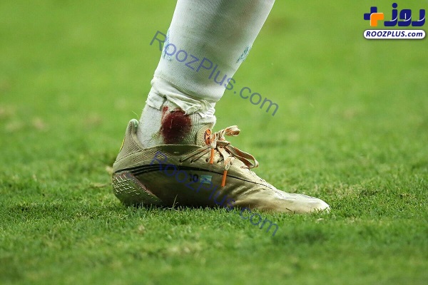 مسی با پای زخمی برای آرژانتین جنگید/عکس