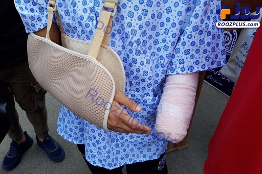 قطع دست جوان ۱۸ ساله در نزاع خیابانی +عکس