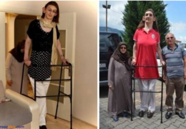 قدبلندترین زن جهان با ٢ متر و ١۵ سانتی‌متر +عکس