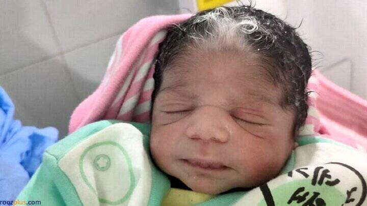تولد نوزادی نادر و عجیب با موهای سفید +عکس