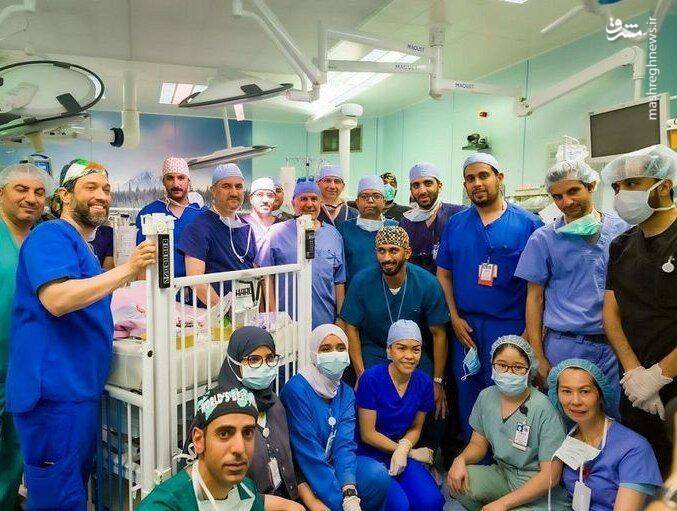 جداسازی دوقلوهای یمنی پس از ۱۵ ساعت عمل جراحی +عکس