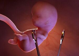 سقط غیرقانونی سالانه ۳۷۰ هزار جنین در کشور